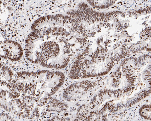 HMGB2 Antibody in Immunohistochemistry (Paraffin) (IHC (P))