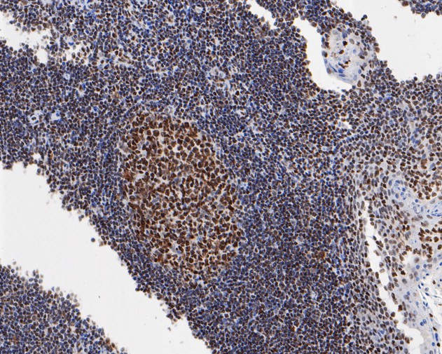 HMGB2 Antibody in Immunohistochemistry (Paraffin) (IHC (P))