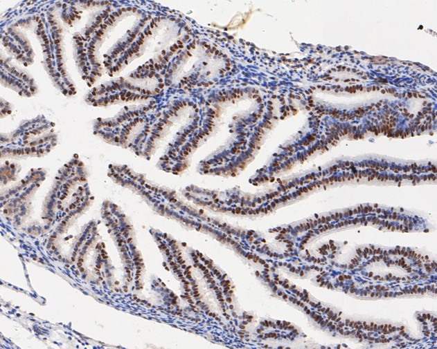 HMGB2 Antibody in Immunohistochemistry (Paraffin) (IHC (P))