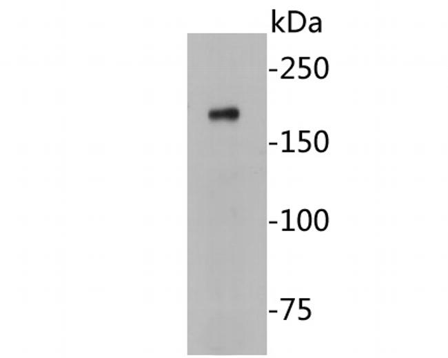 CASPR Antibody in Western Blot (WB)