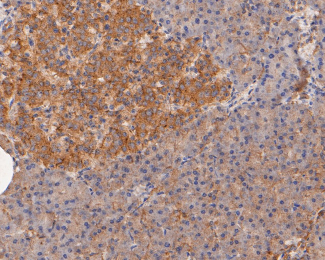 CASK Antibody in Immunohistochemistry (Paraffin) (IHC (P))