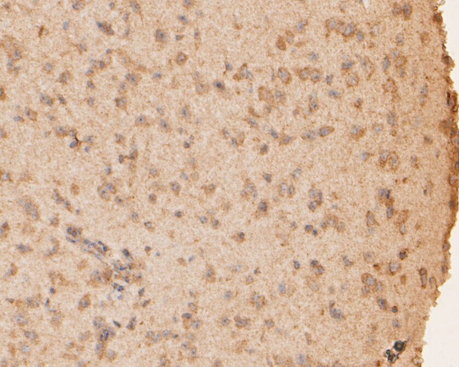 CASK Antibody in Immunohistochemistry (Paraffin) (IHC (P))