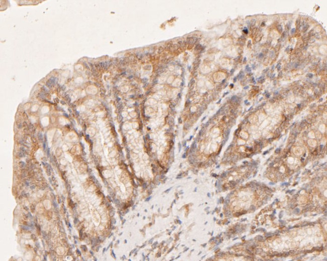 CASK Antibody in Immunohistochemistry (Paraffin) (IHC (P))