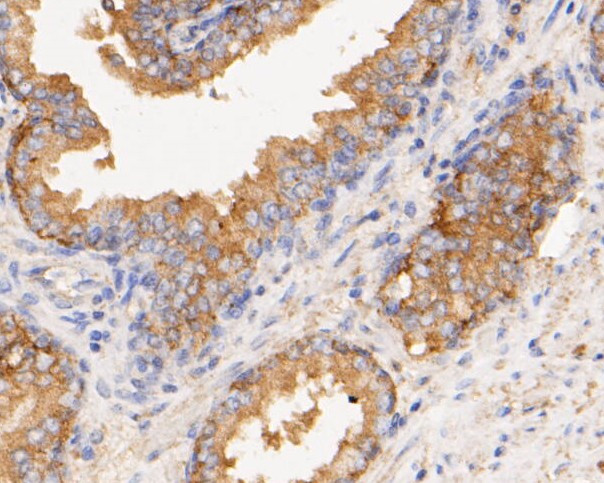 CASK Antibody in Immunohistochemistry (Paraffin) (IHC (P))