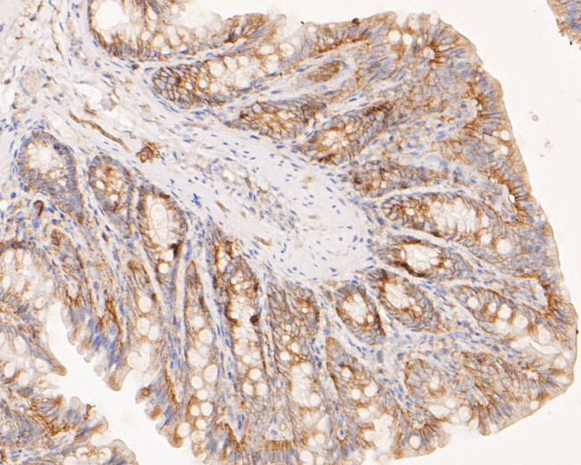 CASK Antibody in Immunohistochemistry (Paraffin) (IHC (P))