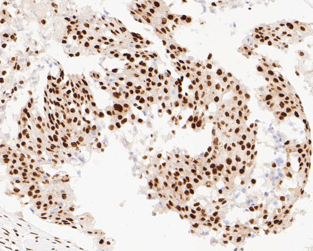 NuMA Antibody in Immunohistochemistry (Paraffin) (IHC (P))