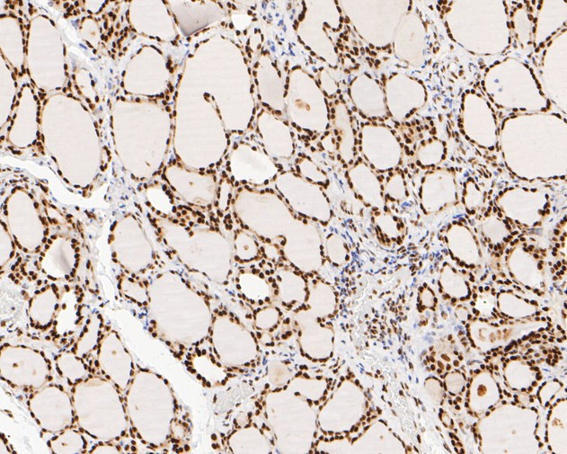 NuMA Antibody in Immunohistochemistry (Paraffin) (IHC (P))