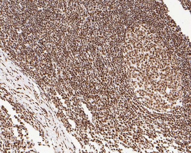 NuMA Antibody in Immunohistochemistry (Paraffin) (IHC (P))