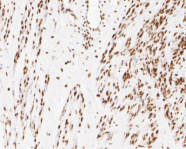 NuMA Antibody in Immunohistochemistry (Paraffin) (IHC (P))