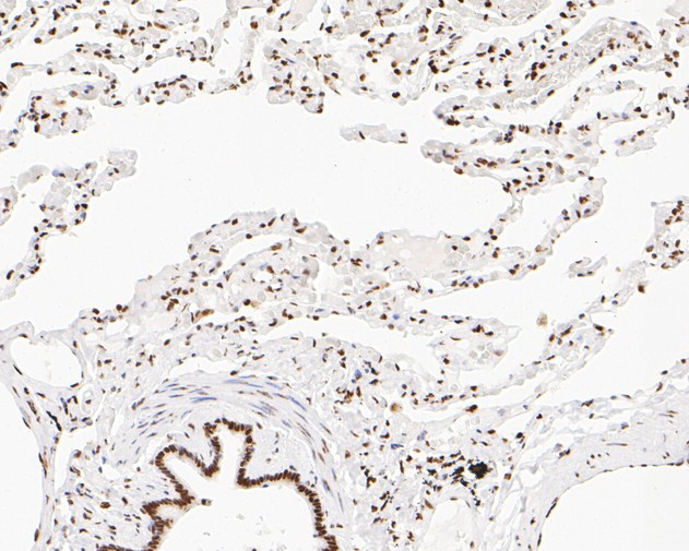 NuMA Antibody in Immunohistochemistry (Paraffin) (IHC (P))