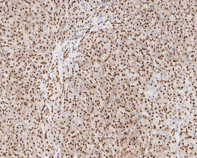 NuMA Antibody in Immunohistochemistry (Paraffin) (IHC (P))