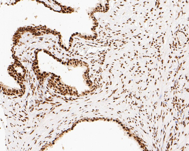 NuMA Antibody in Immunohistochemistry (Paraffin) (IHC (P))