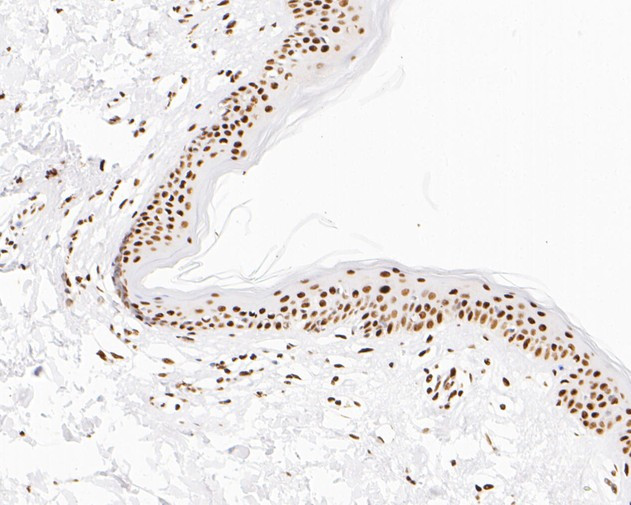 NuMA Antibody in Immunohistochemistry (Paraffin) (IHC (P))