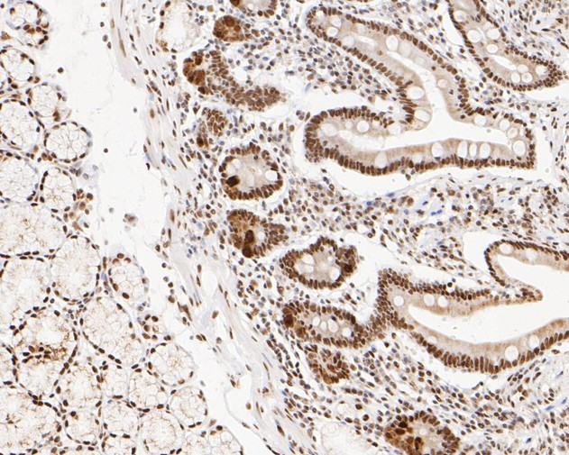 NuMA Antibody in Immunohistochemistry (Paraffin) (IHC (P))