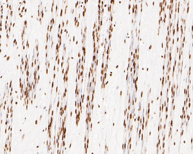 NuMA Antibody in Immunohistochemistry (Paraffin) (IHC (P))