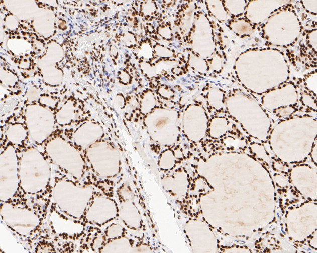 NuMA Antibody in Immunohistochemistry (Paraffin) (IHC (P))