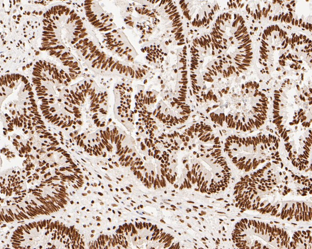 NuMA Antibody in Immunohistochemistry (Paraffin) (IHC (P))