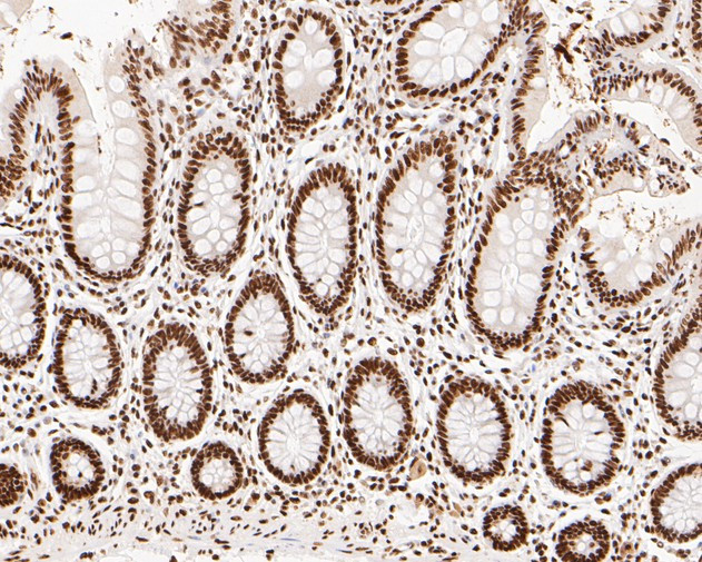 NuMA Antibody in Immunohistochemistry (Paraffin) (IHC (P))