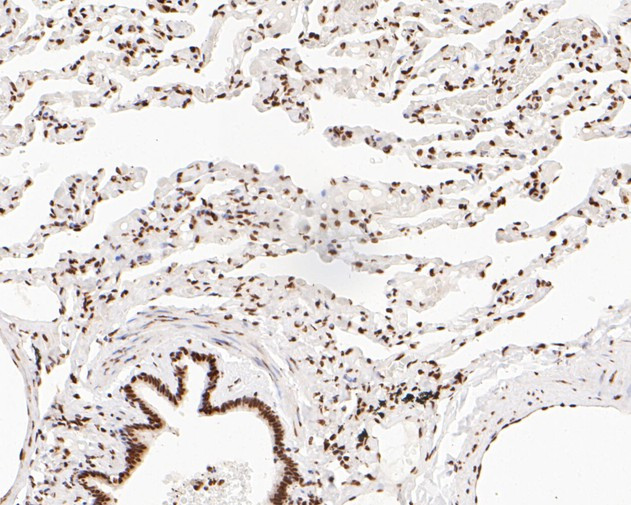 NuMA Antibody in Immunohistochemistry (Paraffin) (IHC (P))