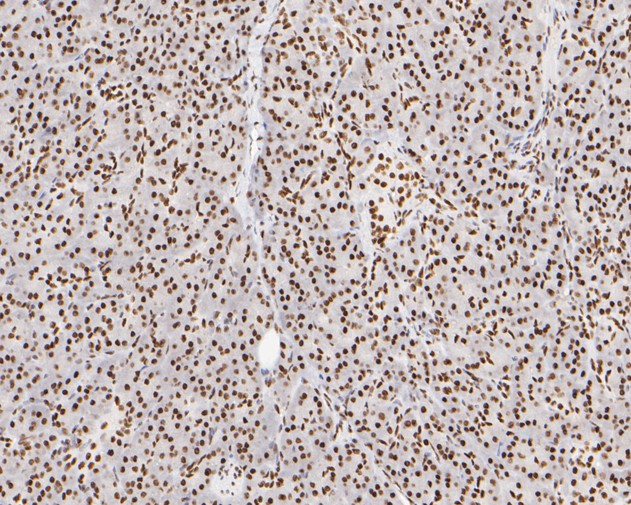 NuMA Antibody in Immunohistochemistry (Paraffin) (IHC (P))