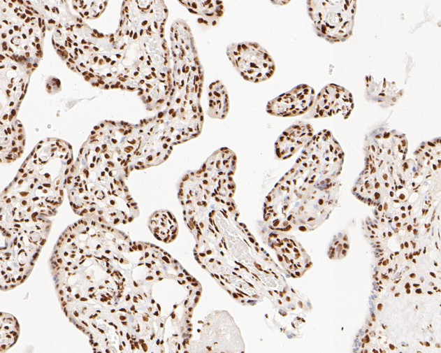 NuMA Antibody in Immunohistochemistry (Paraffin) (IHC (P))