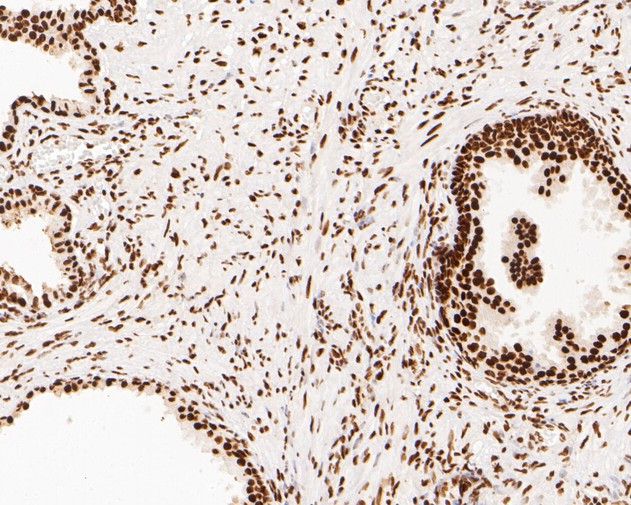 NuMA Antibody in Immunohistochemistry (Paraffin) (IHC (P))