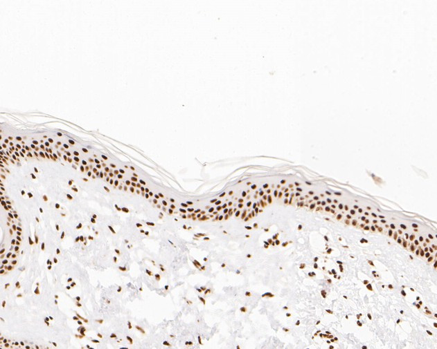 NuMA Antibody in Immunohistochemistry (Paraffin) (IHC (P))