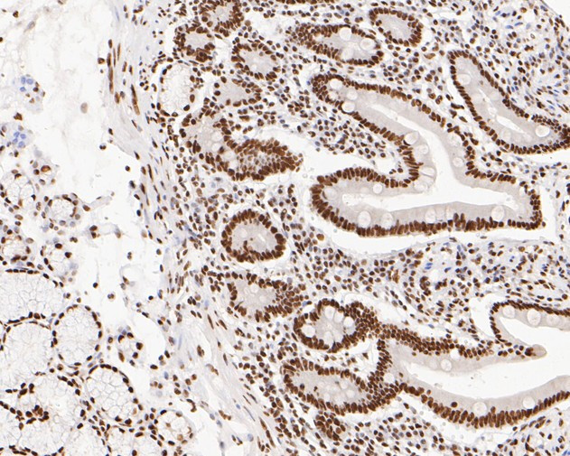 NuMA Antibody in Immunohistochemistry (Paraffin) (IHC (P))