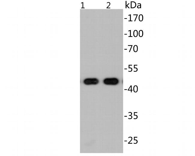 SARS-CoV-2 Nucleocapsid Antibody in Western Blot (WB)