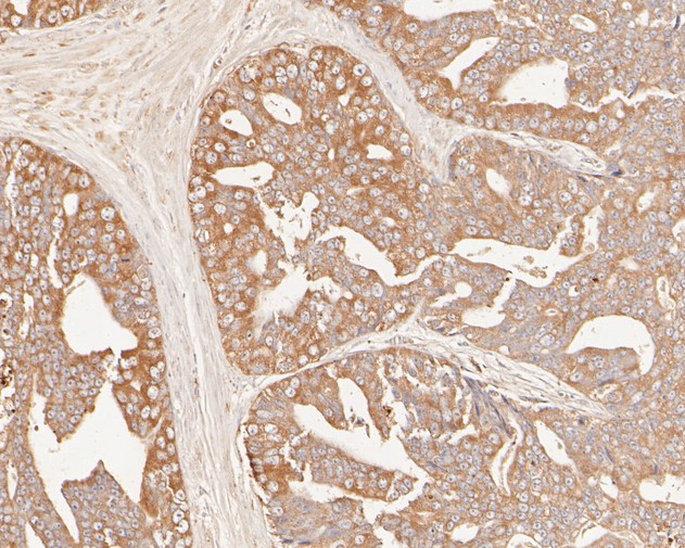 GADD34 Antibody in Immunohistochemistry (Paraffin) (IHC (P))