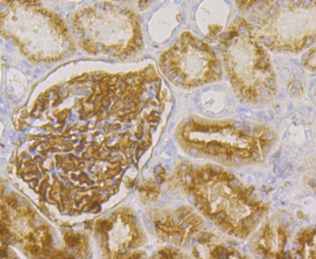 CD249 Antibody in Immunohistochemistry (Paraffin) (IHC (P))