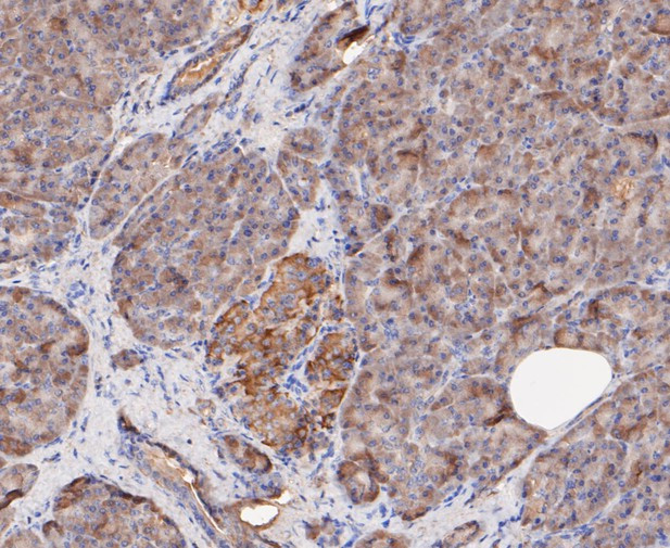 FBP1 Antibody in Immunohistochemistry (Paraffin) (IHC (P))