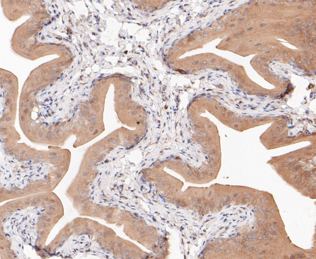 FBP1 Antibody in Immunohistochemistry (Paraffin) (IHC (P))