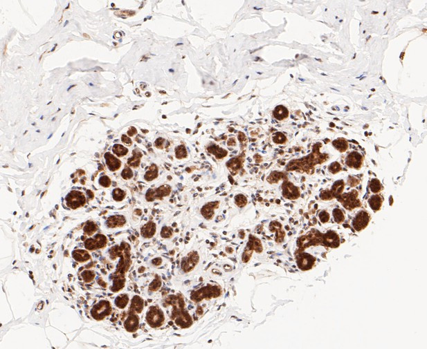 PSMD14 Antibody in Immunohistochemistry (Paraffin) (IHC (P))