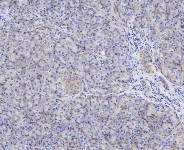 PSMD14 Antibody in Immunohistochemistry (Paraffin) (IHC (P))