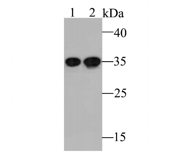 PSMD14 Antibody in Western Blot (WB)