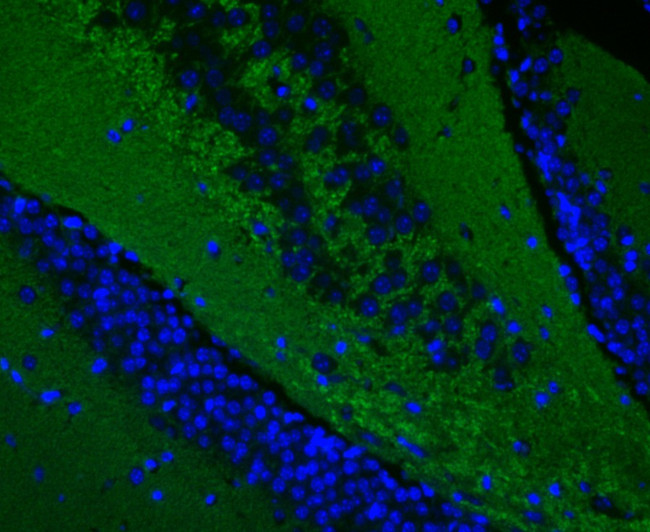 Synapsin II Antibody in Immunohistochemistry (Paraffin) (IHC (P))