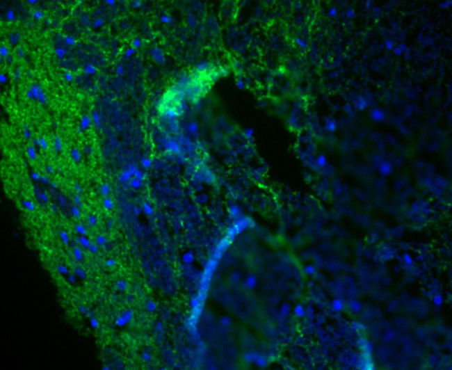 Synapsin II Antibody in Immunohistochemistry (Paraffin) (IHC (P))