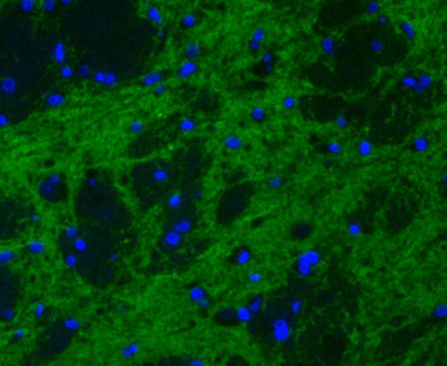 Synapsin II Antibody in Immunohistochemistry (Paraffin) (IHC (P))