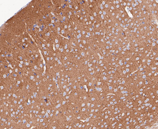 Synapsin II Antibody in Immunohistochemistry (Paraffin) (IHC (P))