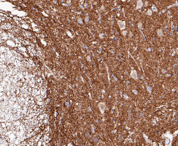 Synapsin II Antibody in Immunohistochemistry (Paraffin) (IHC (P))