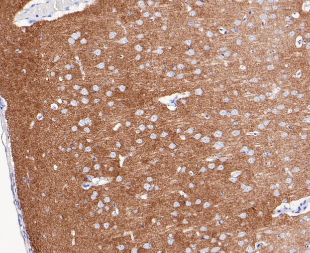 Synapsin II Antibody in Immunohistochemistry (Paraffin) (IHC (P))