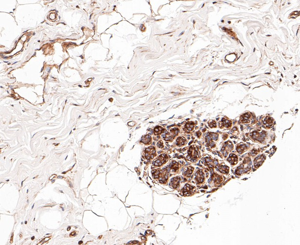 PRKAR2A Antibody in Immunohistochemistry (Paraffin) (IHC (P))