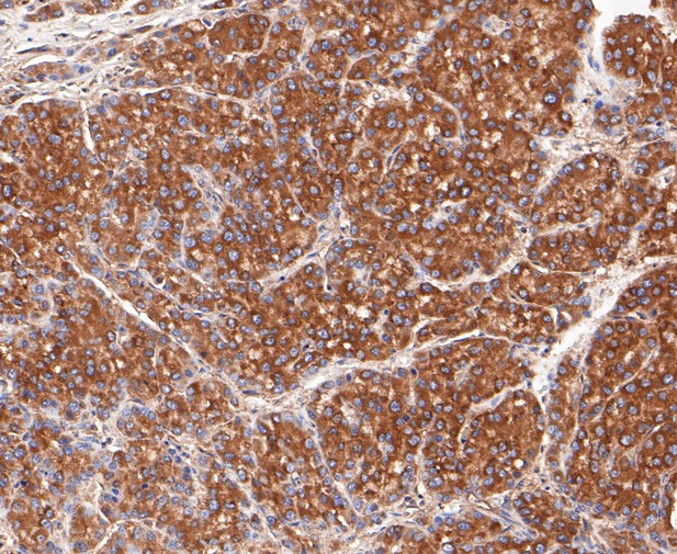 PRKAR2A Antibody in Immunohistochemistry (Paraffin) (IHC (P))