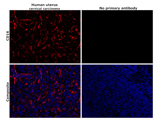 CD16 Antibody in Immunohistochemistry (Paraffin) (IHC (P))