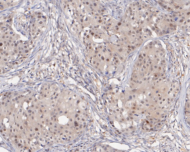 PSMA2 Antibody in Immunohistochemistry (Paraffin) (IHC (P))