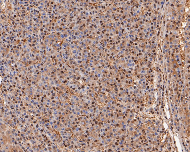 PSMA2 Antibody in Immunohistochemistry (Paraffin) (IHC (P))