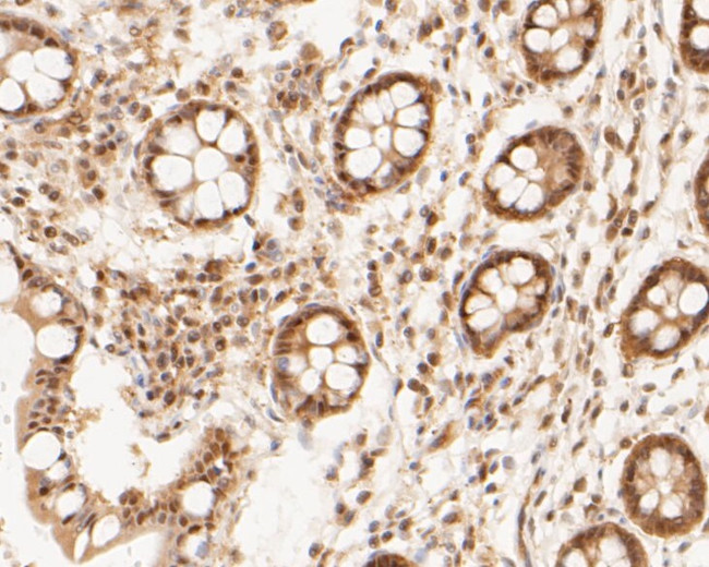 PSMA2 Antibody in Immunohistochemistry (Paraffin) (IHC (P))