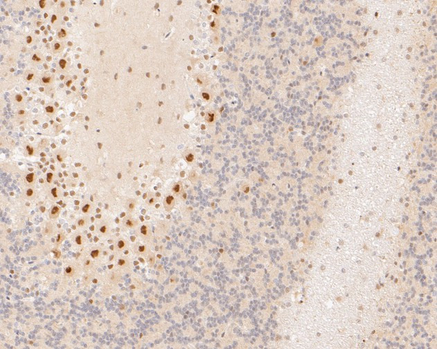 PSMA2 Antibody in Immunohistochemistry (Paraffin) (IHC (P))