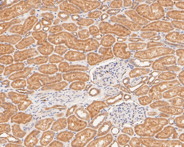 KIFAP3 Antibody in Immunohistochemistry (Paraffin) (IHC (P))